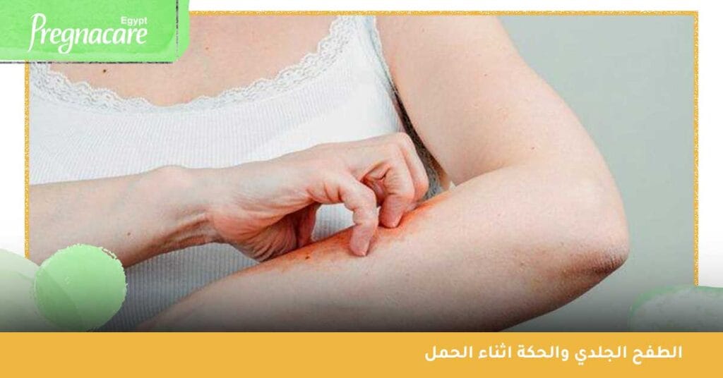 الطفح الجلدي والحكة اثناء الحمل