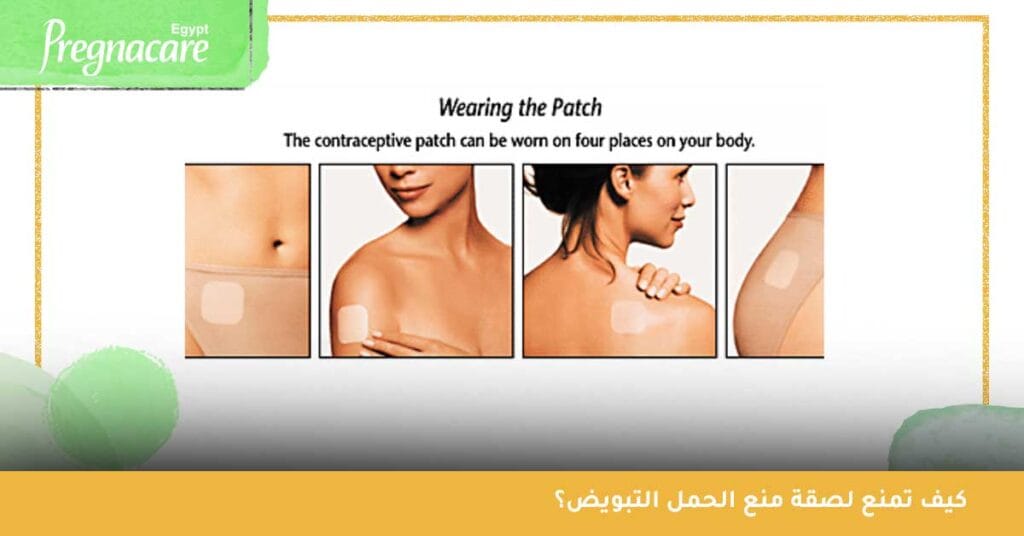 كيف تمنع لصقة منع الحمل التبويض وما هي أماكن وضعها؟