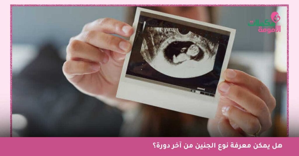 السونار، تحليل الدم، الفحص المنزلي - أيهما الأدق لتحديد جنس الجنين؟!
معرفة نوع الجنين
معرفة نوع الجنين من تاريخ الحمل
في أي أسبوع يظهر نوع الجنين الذكر
طريقة مضمونة 100 لمعرفة نوع الجنين
هل يظهر نوع الجنين في أول الشهر الرابع
معرفة نوع الجنين من آخر دورة
كيف اعرف نوع الجنين من ورقة السونار