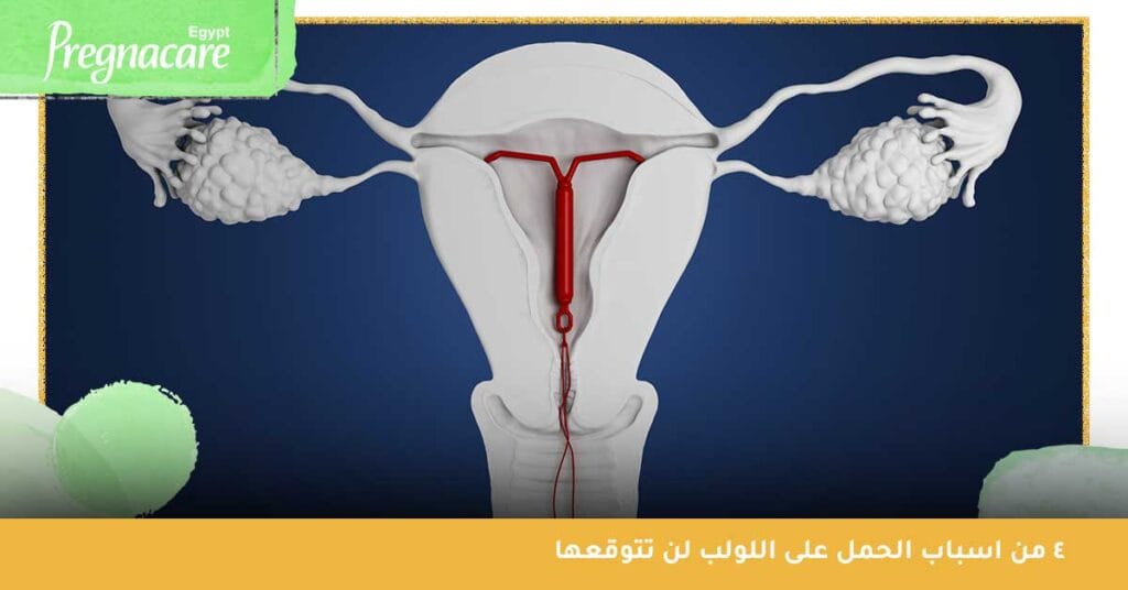 4 من اسباب الحمل على اللولب لن تتوقعها