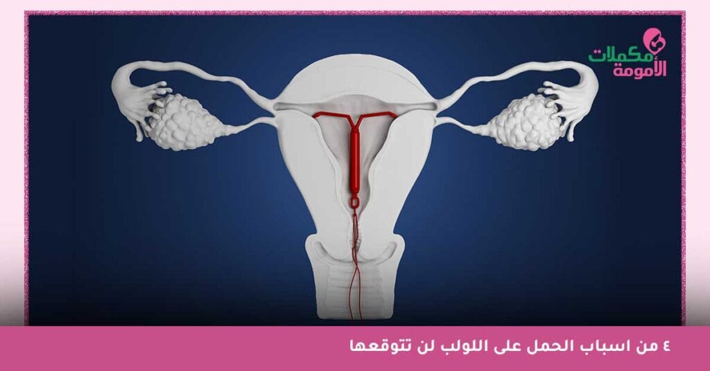 الحمل فوق اللولب بالصور - أعراض الحمل على اللولب قبل الدورة - تجربتي مع الحمل على اللولب - متى يبان الحمل مع اللولب؟ - نسبة الحمل على اللولب - نسبة الحمل على اللولب النحاسي - نسبة الحمل مع اللولب النحاسي - هل يكتمل الحمل مع وجود اللولب - مخاطر الحمل على اللولب
