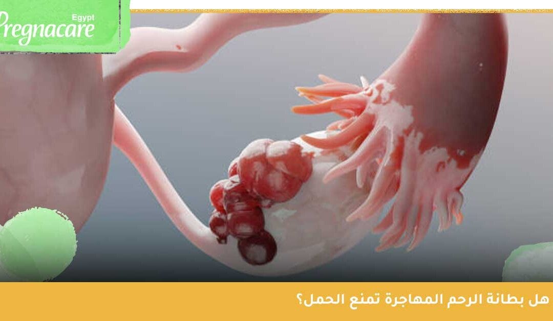 هل بطانة الرحم المهاجرة تمنع الحمل؟ اكتشفي كل ما يتعلق بتلك الحالة المزمنة