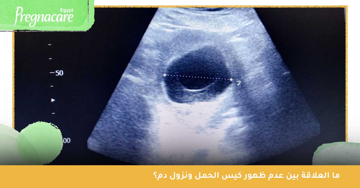 هل يمكن أن يتأخر ظهور الجنين في كيس الحمل؟ وهل هذا دليل على الإجهاض؟ - تجربتي في تأخر ظهور الجنين في كيس الحمل - عدم ظهور الجنين في كيس الحمل في الأسبوع السادس - هل تأخر ظهور كيس الحمل له علاقة بنوع الجنين - متى يظهر الجنين في كيس الحمل المتأخر - عدم ظهور كيس الحمل ونزول دم