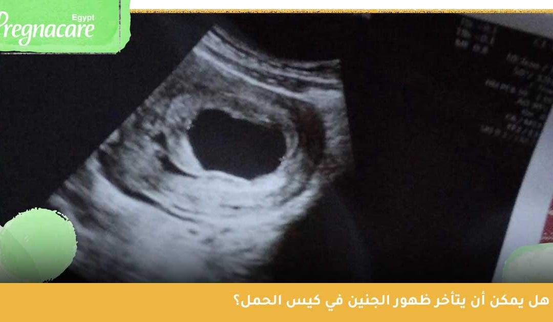 هل يمكن أن يتأخر ظهور الجنين في كيس الحمل؟ وهل هذا دليل على الإجهاض؟
