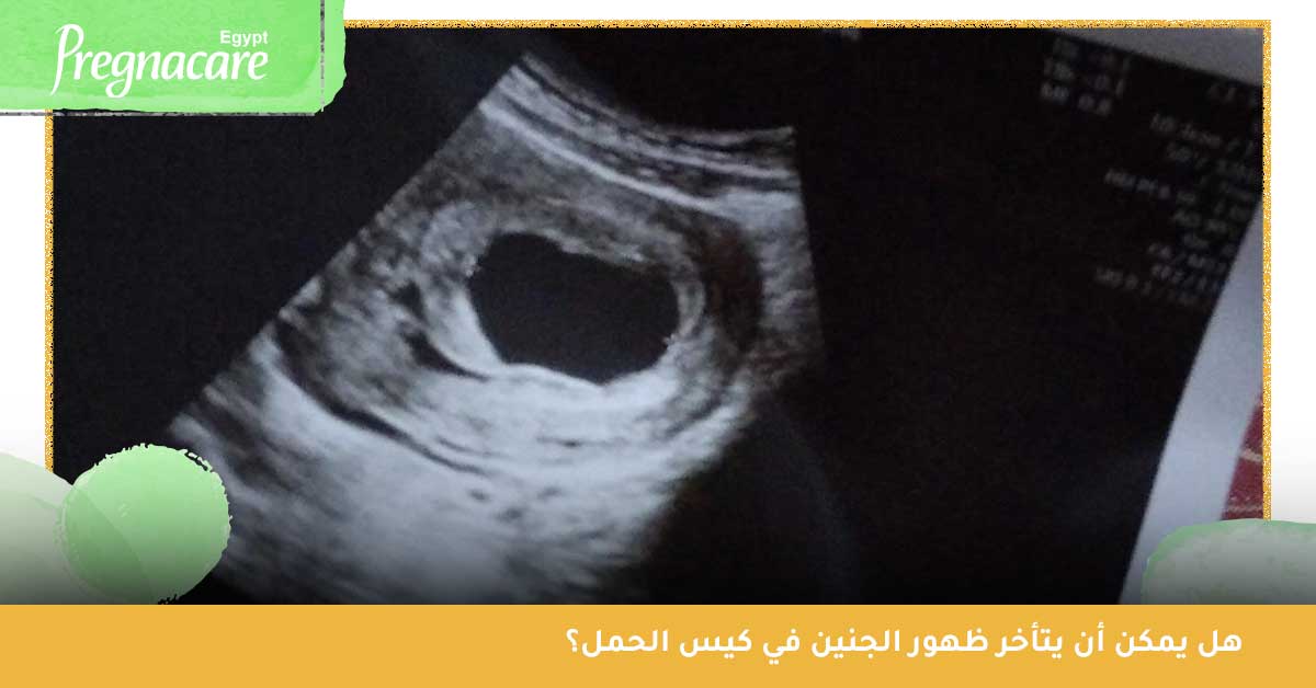 هل-يمكن-أن-يتأخر-ظهور-الجنين-في-كيس-الحمل؟ هل يمكن أن يتأخر ظهور الجنين في كيس الحمل؟ وهل هذا دليل على الإجهاض؟ - تجربتي في تأخر ظهور الجنين في كيس الحمل - عدم ظهور الجنين في كيس الحمل في الأسبوع السادس - هل تأخر ظهور كيس الحمل له علاقة بنوع الجنين - متى يظهر الجنين في كيس الحمل المتأخر - عدم ظهور كيس الحمل ونزول دم